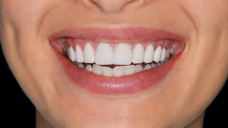 முத்துப்போன்ற பற்களுக்கு எளிய வீட்டு வைத்தியம்: பற்களையும் ஈறுகளையும் வலுப்படுத்த நிபுணர்கள் சொல்லும் ஆலோசனைகள்!